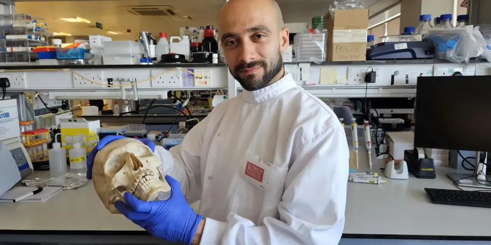 Scientists transform sheep’s wool into a revolutionary bone regeneration material