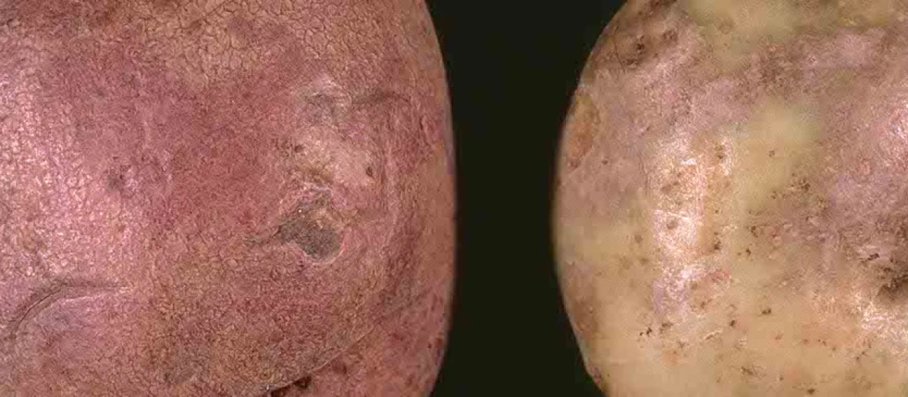 Silver scurf of potato