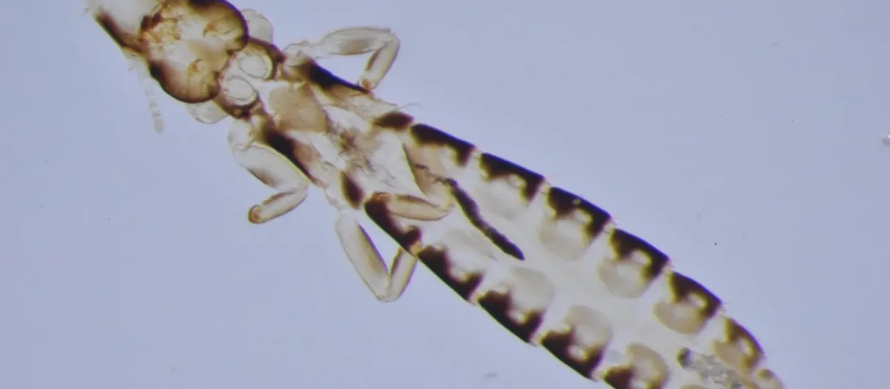 Duck louse