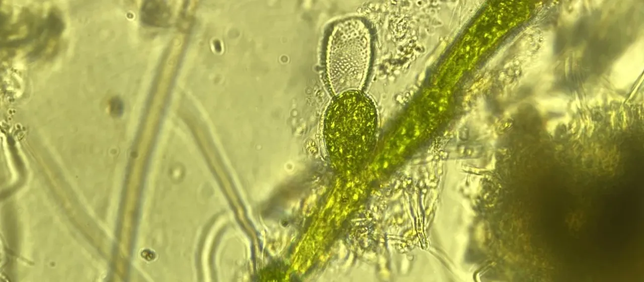 Bulbochaete