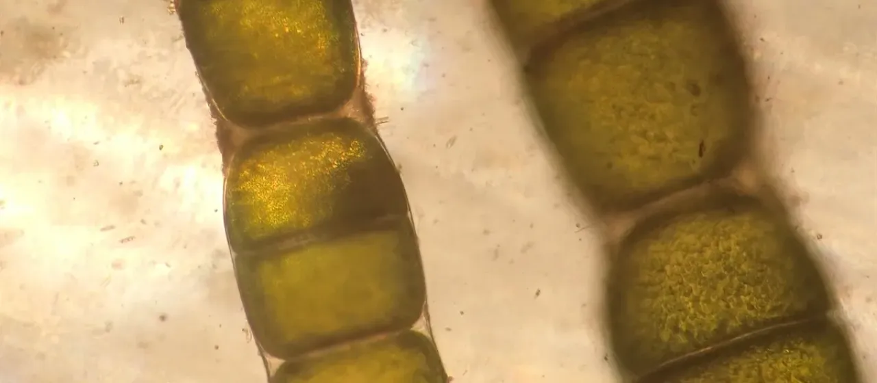 Chaetomorpha melagonium