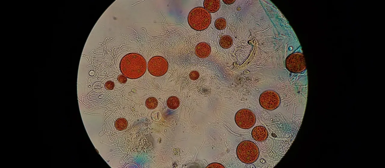 Haematococcus lacustris (Girod-Chantrans) Rostafinski