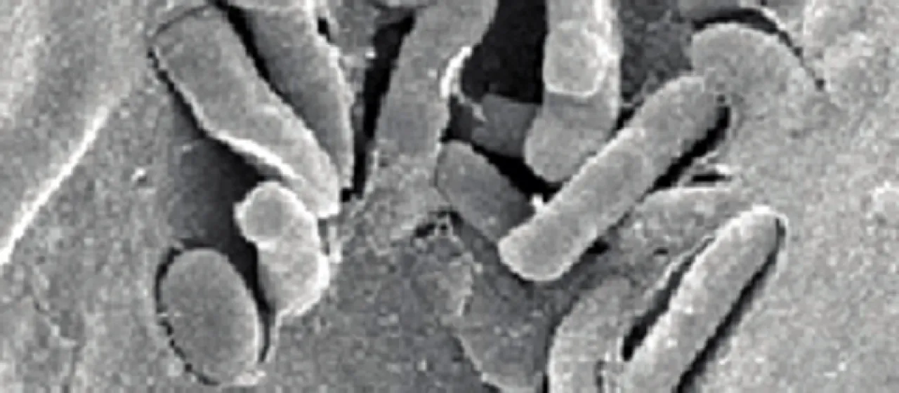 Pantoea ananatis