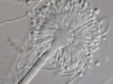 Aspergillus versicolor