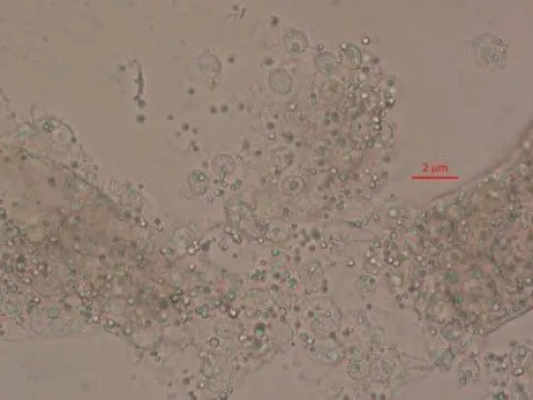 Pasteuria penetrans