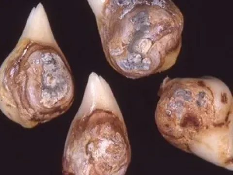 Penicillium glaucum