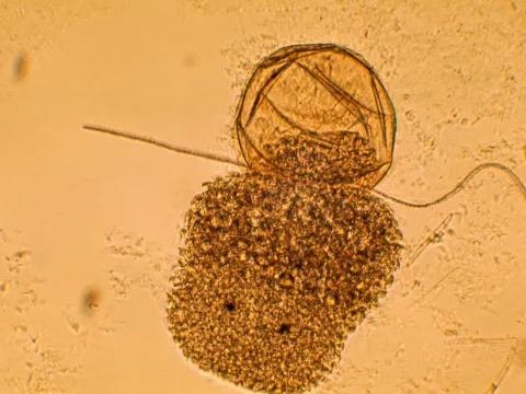 Phytophthora vesicula