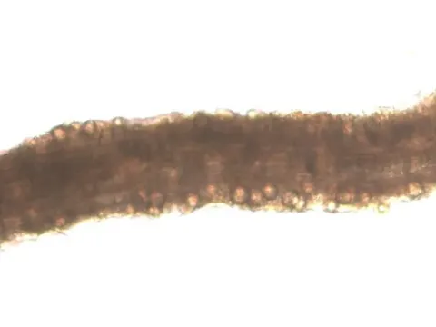 Root pythium