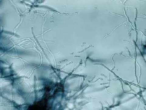 Streptomyces avermitilis