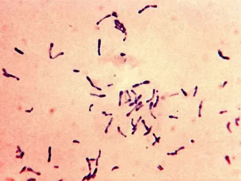 Renibacteriosis