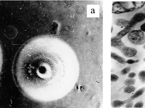 Spiroplasmosis