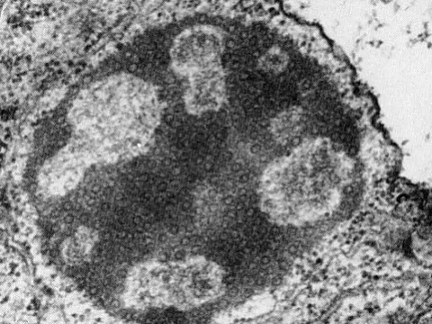Soymovirus