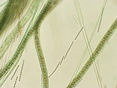 Jaaginema disease