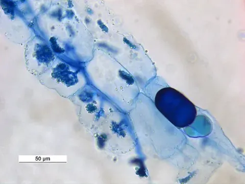 Arbuscular mycorrhiza