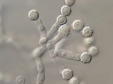 Microascus longirostris