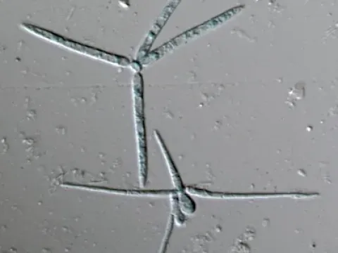Annulatascus