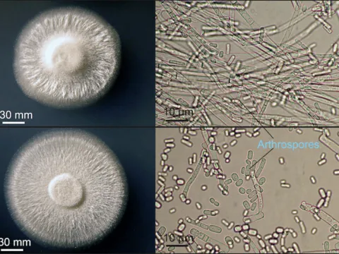 Dipodascus