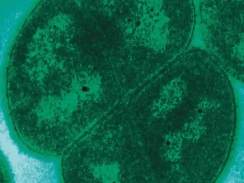 Deinococcus radiodurans