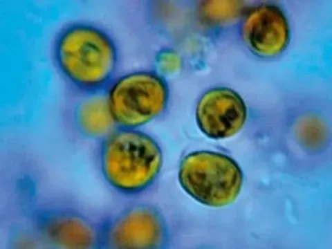 Изохризидовые водоросли