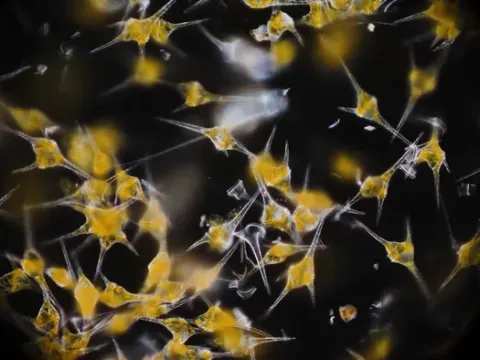 Ceratium