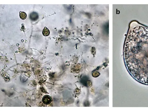 Фитофтороз Phytophthora hedraiandra
