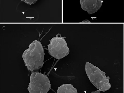 Pseudochattonella