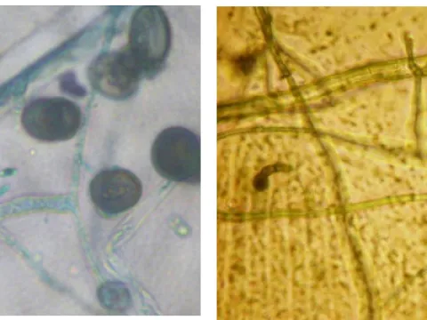Ceratocystis paradoxa