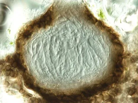 Didymella leaf spot