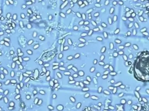 Nosema disease