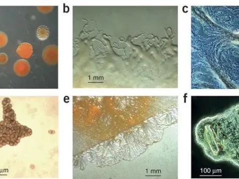 Sorangium cellulosum