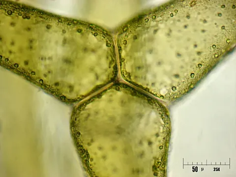 Hydrodictyon