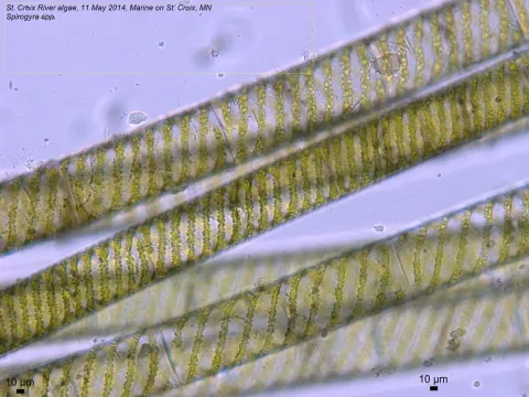 Spirogyra