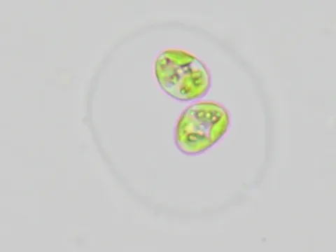 Oocystis