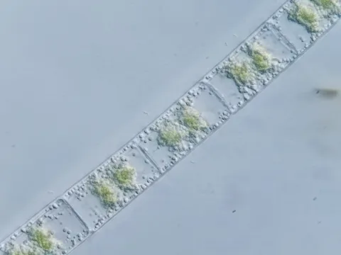 Zygnema