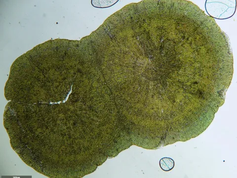 Coleochaete