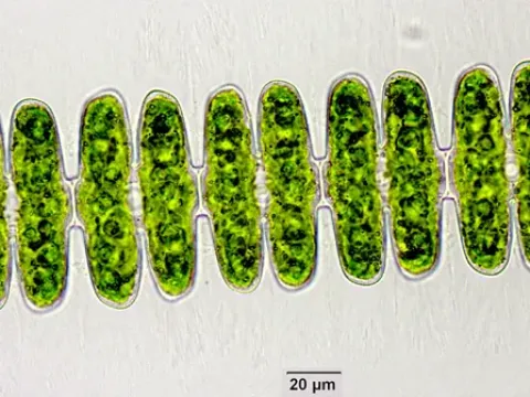 Spondylosium