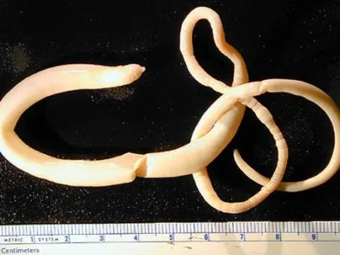 Acanthocephalans