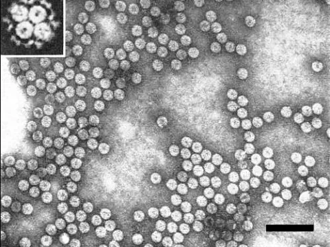 Cowpea chlorotic mottle virus
