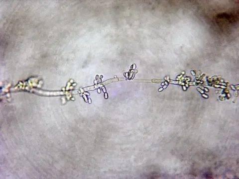 Hormonema
