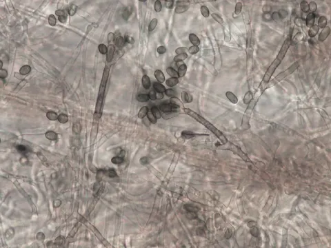 Stachybotrys chartarum