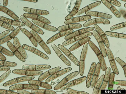 Stenocarpella maydis