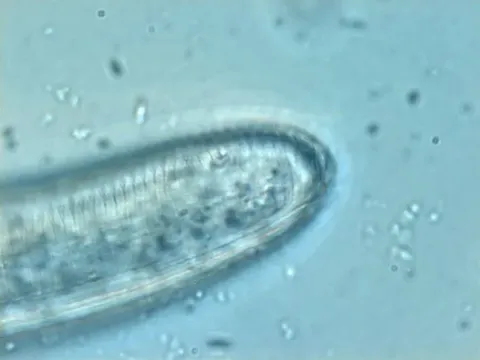 Rotylenchus robustus