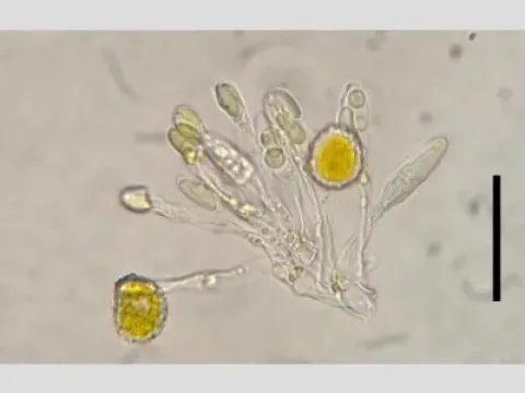 Sphenospora kevorkianii