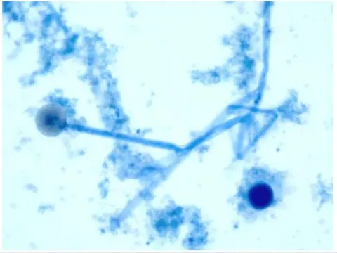 Mucor circinelloides