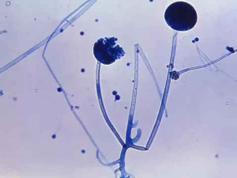 Rhizopus arrhizus