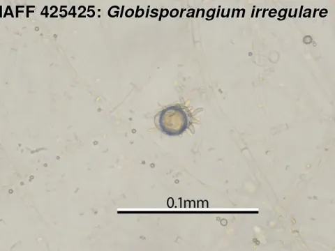 Globisporangium irregulare