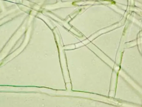 Hypochnus sasakii