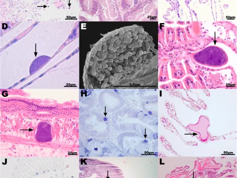 Rickettsia-like organisms