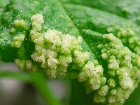 Edema