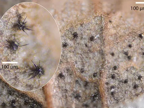 Gibbera myrtilli